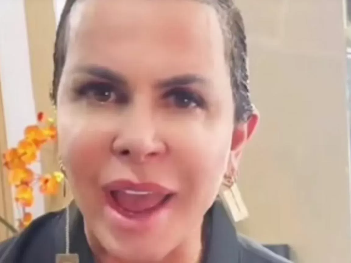 Gretchen reflete sobre alopecia e surge sem apliques em foto