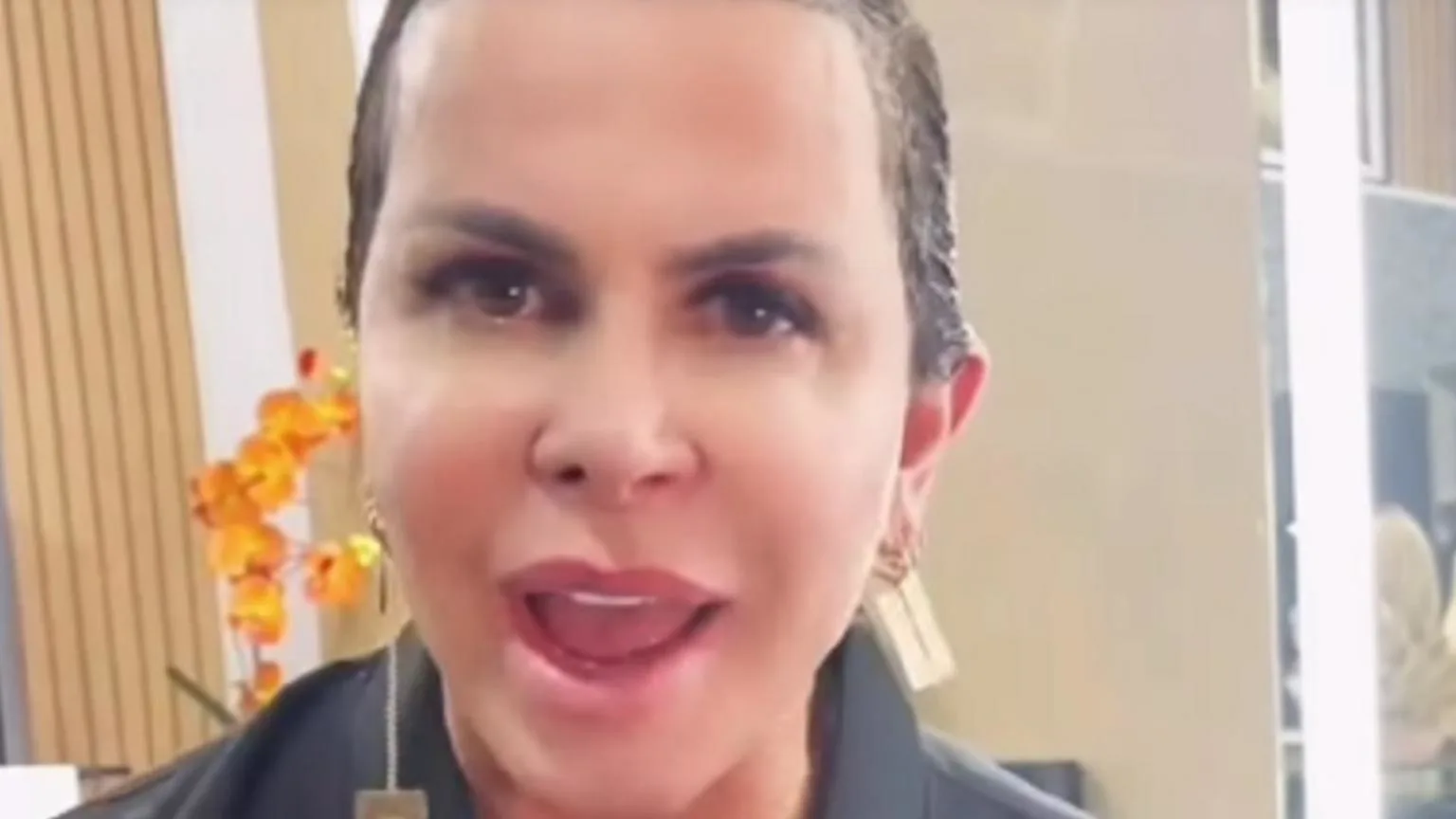 Gretchen reflete sobre alopecia e surge sem apliques em foto