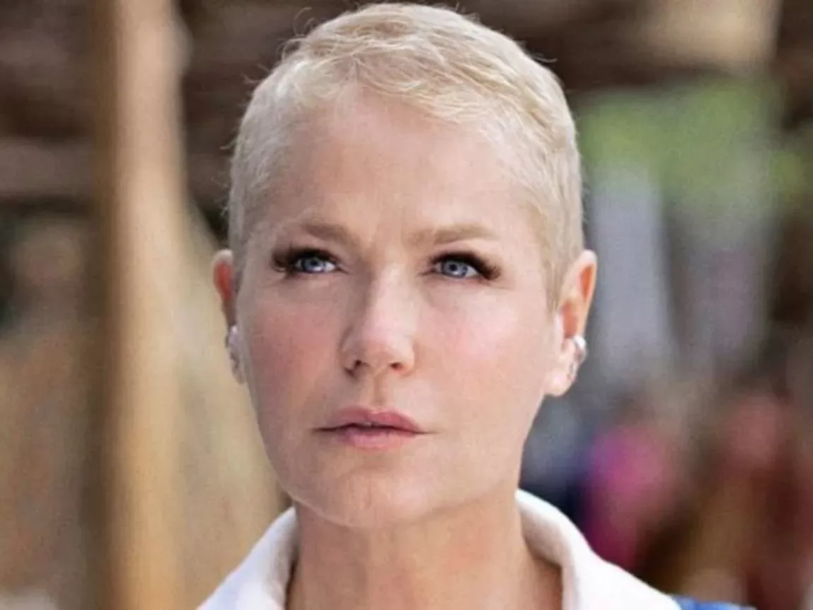 Xuxa Meneghel realiza cirurgia no joelho para se preparar para turnê em 2025