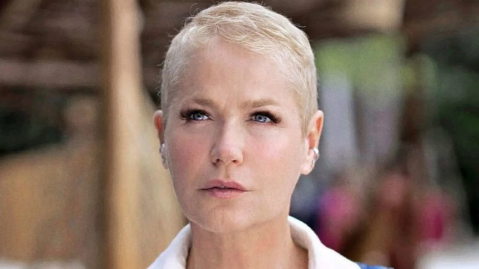 Xuxa Meneghel realiza cirurgia no joelho para se preparar para turnê em 2025