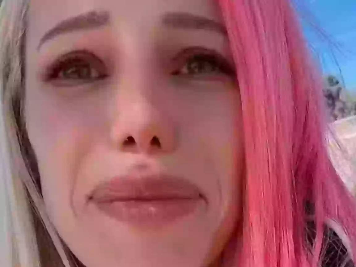 Cantora revela osteoporose após uso de Ozempic: especialistas alertam sobre perda óssea em emagrecimento rápido