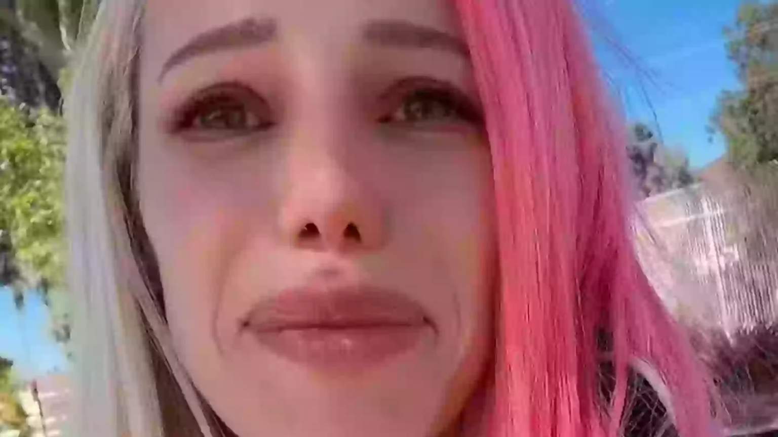 Cantora revela osteoporose após uso de Ozempic: especialistas alertam sobre perda óssea em emagrecimento rápido