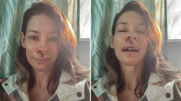Evangeline Lilly surge ensanguentada após desmaio na praia e revela drama de saúde misterioso