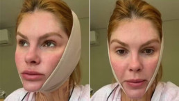 Bárbara Evans diverte seguidores ao mostrar perrengue com tratamento para papada: 'Eu sou um meme'