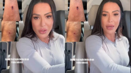 Gracyanne Barbosa sofre acidente na academia e faz reflexão: 'A gente não pode desanimar'