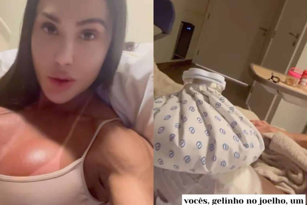 Gracyanne Barbosa atualiza estado de saúde após cirurgia: 'Super inchada'