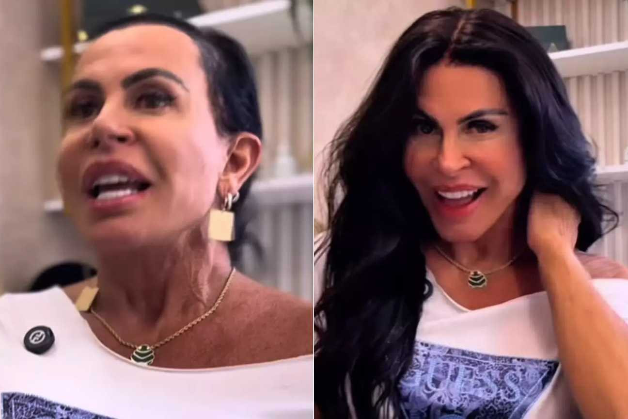Gretchen revela luta contra alopecia e explica uso de perucas para autoestima