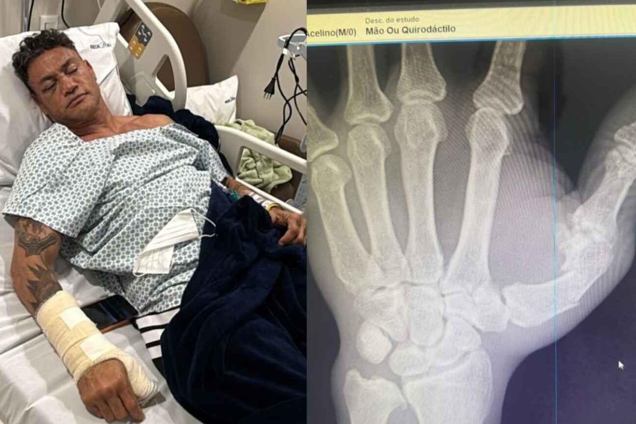 Popó é internado e passará por cirurgia após briga em luta com Wanderlei
