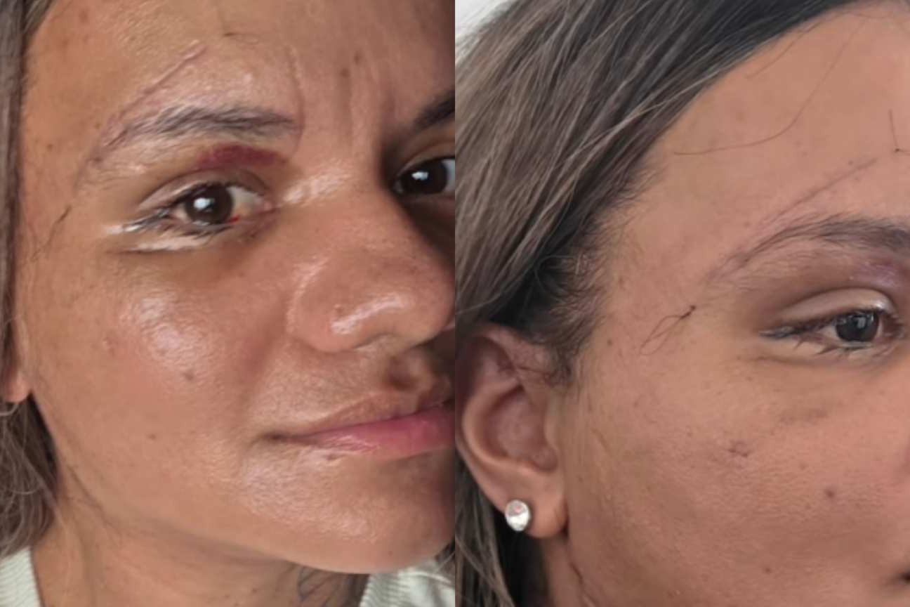 Agredida com 61 socos em elevador celebra: 'Grata por ter minha identidade de volta'