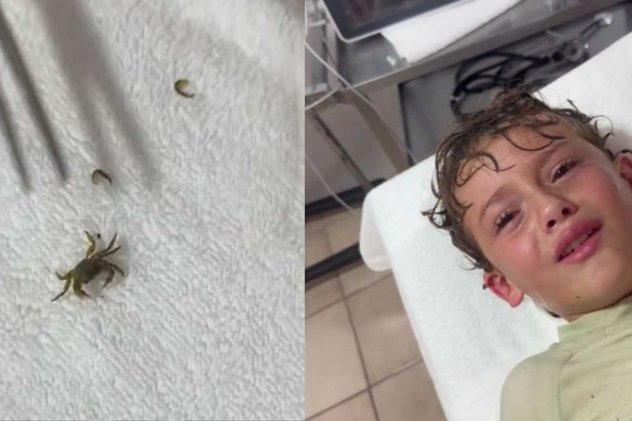 Menino tem caranguejo vivo retirado do ouvido e vídeo do resgate viraliza