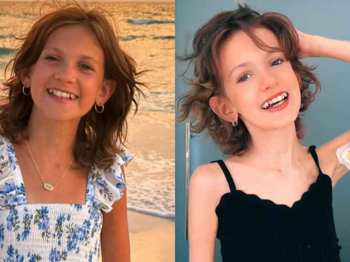 Morre a influenciadora Zuza Beine, aos 14 anos, após 11 anos de luta contra o câncer