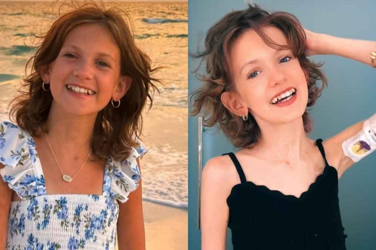 Morre a influenciadora Zuza Beine, aos 14 anos, após 11 anos de luta contra o câncer