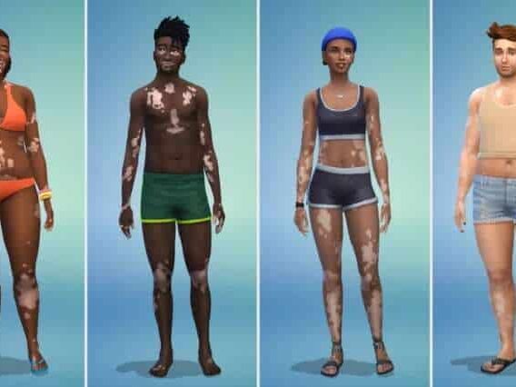 The Sims 4 ganha recurso de vitiligo em atualização gratuita