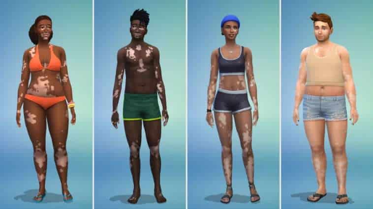 The Sims 4 ganha recurso de vitiligo em atualização gratuita