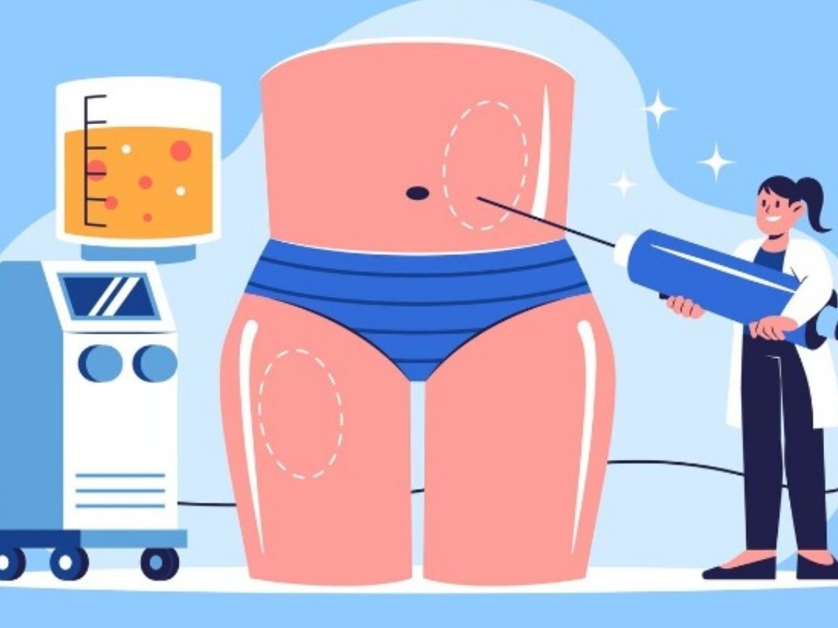 Diga tchau à obesidade: Cirurgia Bariátrica x Remédios - Qual a melhor opção para você?