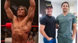 Zac Efron fez tratamento incomum após contusões em filme