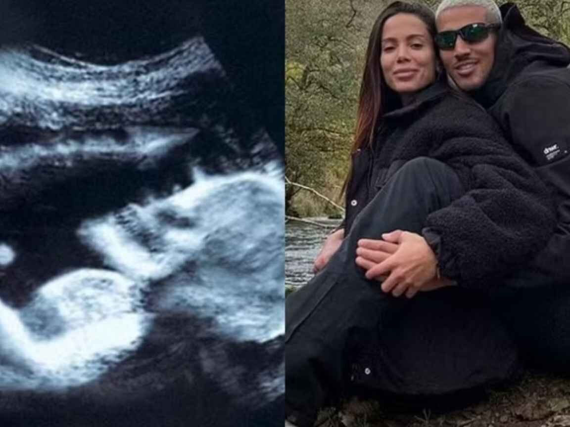 Anitta posta mais uma foto temática de gravidez para Halloween
