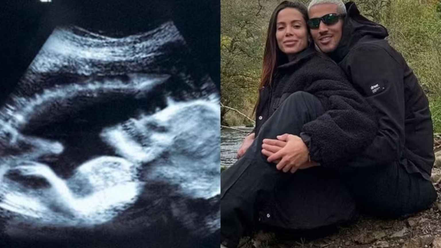 Anitta posta mais uma foto temática de gravidez para Halloween