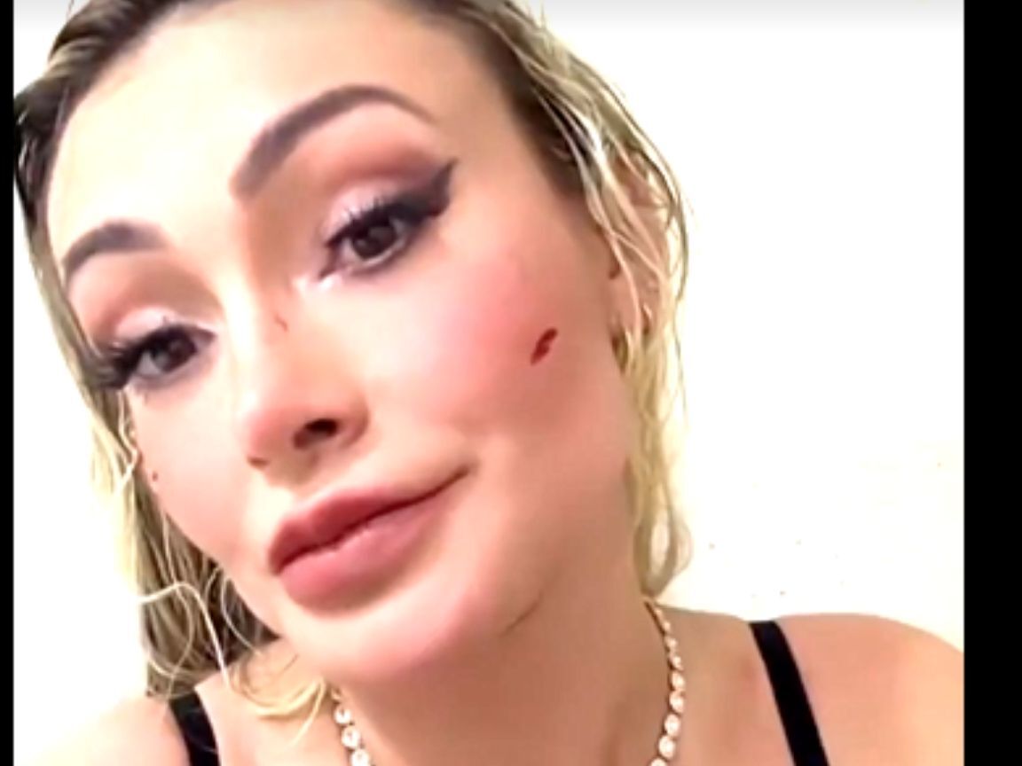 Andressa Urach vai parar no hospital após briga com Juju Ferrari em festa