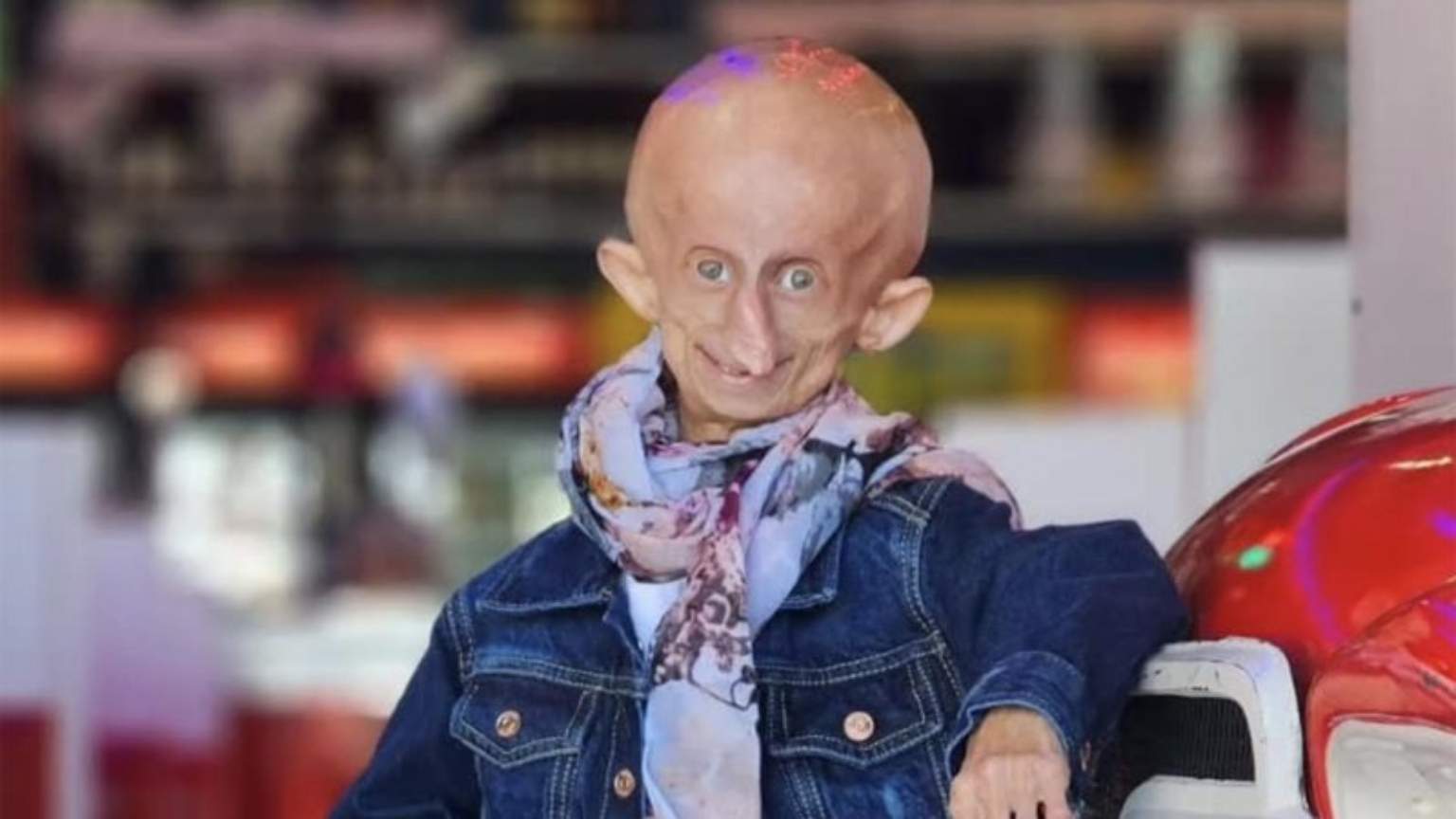 Influenciadora Beandri Booysen morre aos 19 anos devido à Progéria