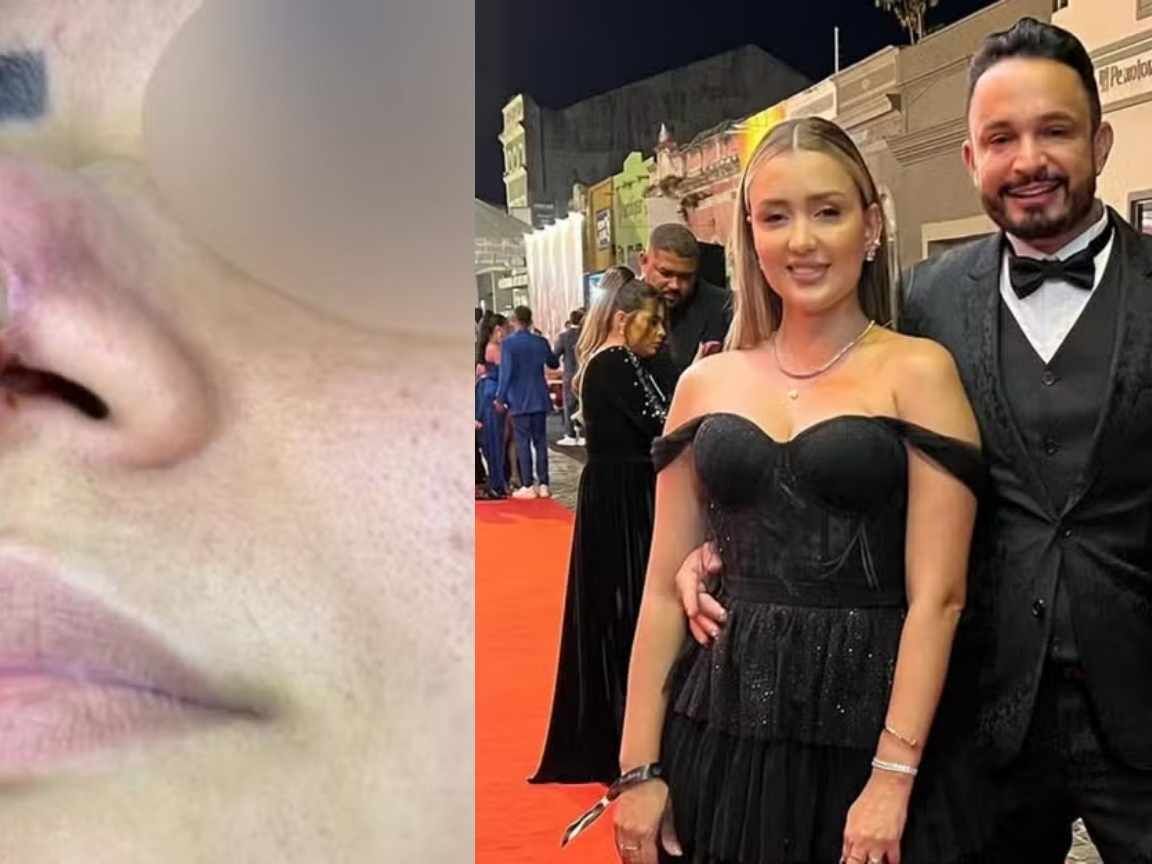 Influenciadores Karine Gouveia e Paulo César Dias acumulam 60 denúncias por lesões graves em clínica de estética