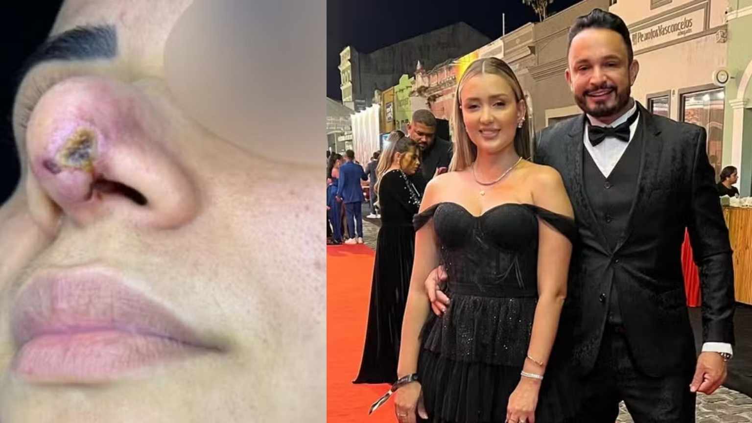 Influenciadores Karine Gouveia e Paulo César Dias acumulam 60 denúncias por lesões graves em clínica de estética