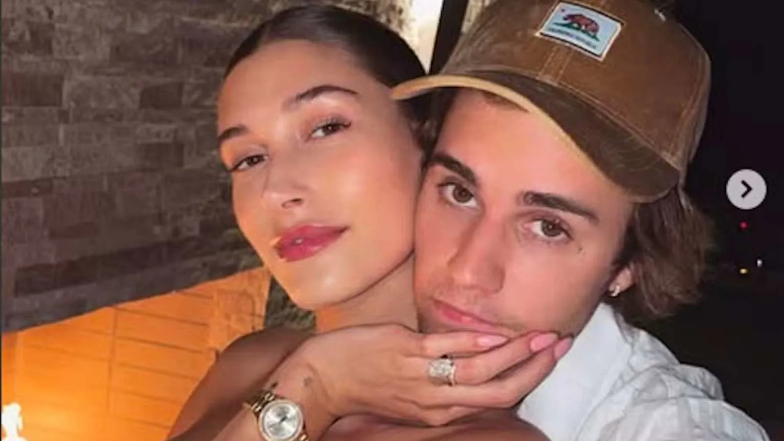 Amigos aconselham Hailey Bieber a se separar de Justin Bieber após crise no casamento