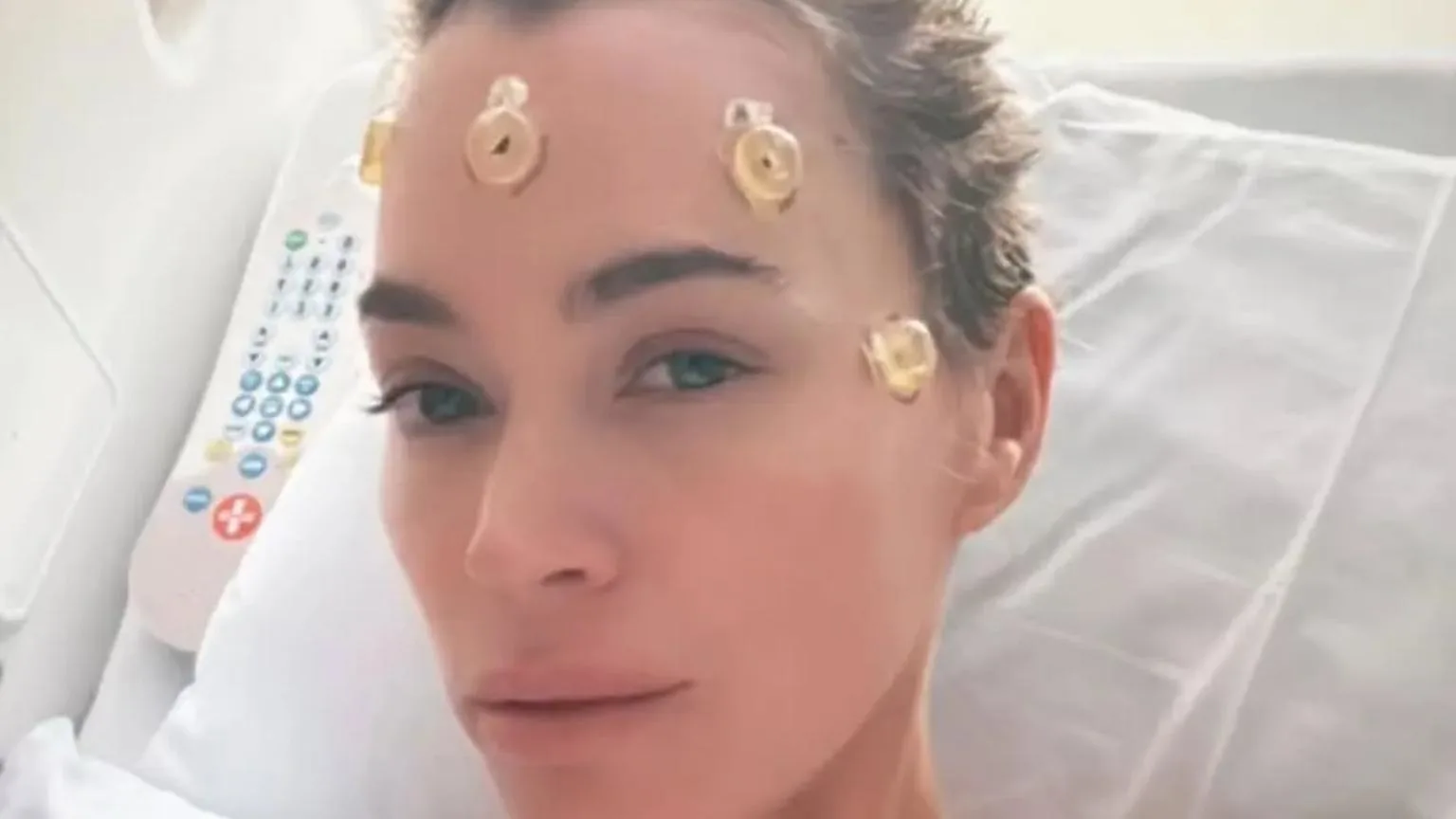 Teddi Mellencamp revela luta contra tumores cerebrais: 'achei que ia morrer'