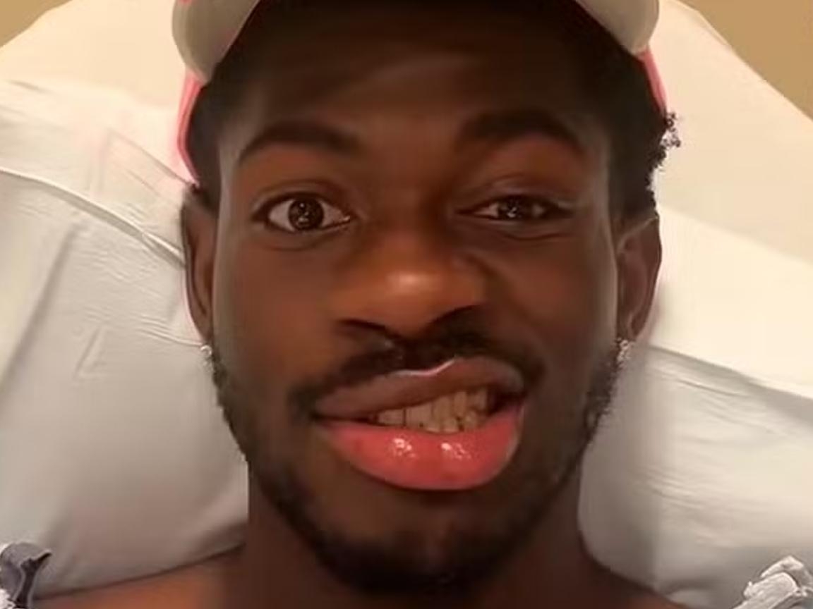 Lil Nas X é internado e preocupa fãs após paralisia facial: 'Não consigo nem rir, mano'
