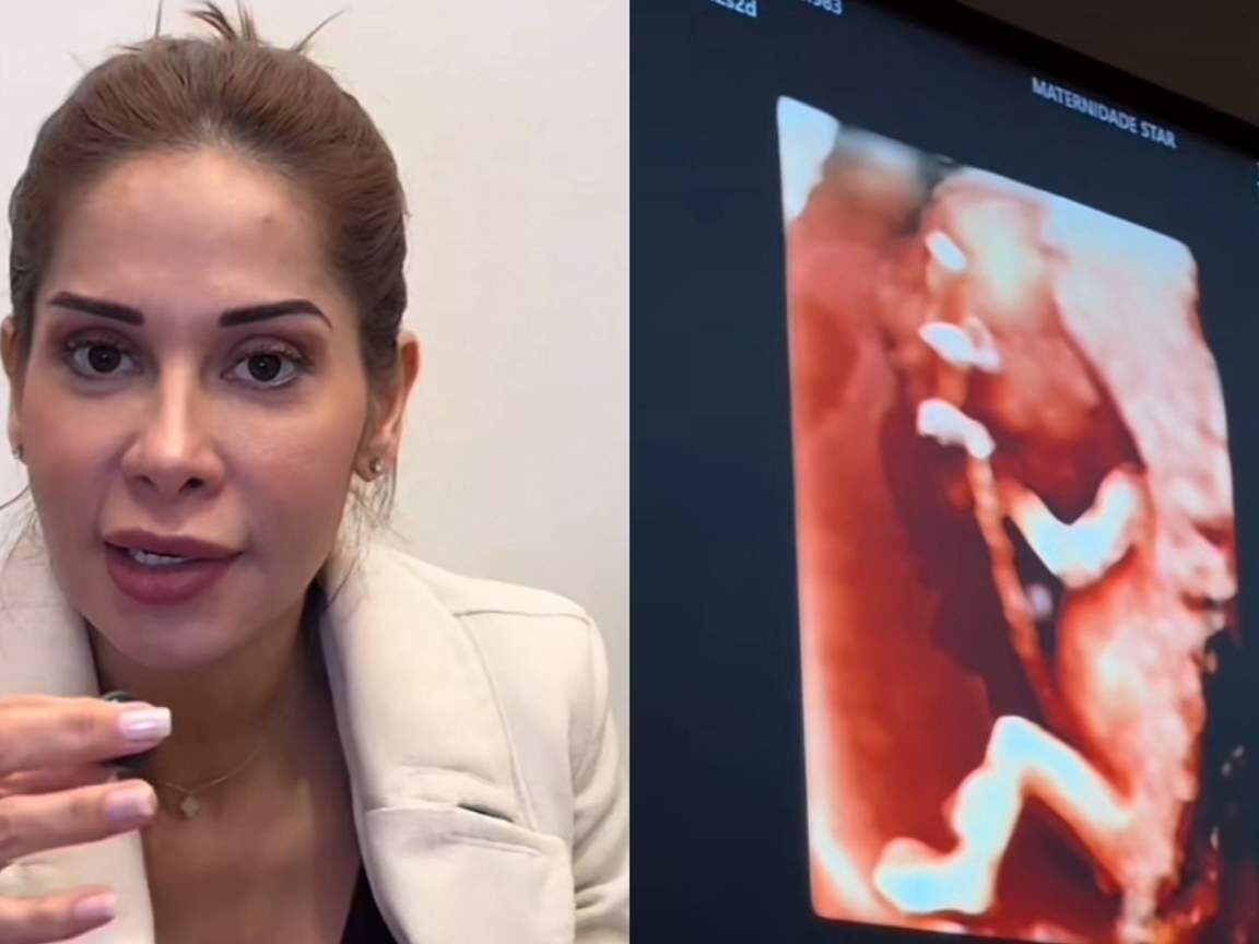Maíra Cardi compartilha ultrassom da segunda gravidez e desabafa sobre ansiedade com exames genéticos