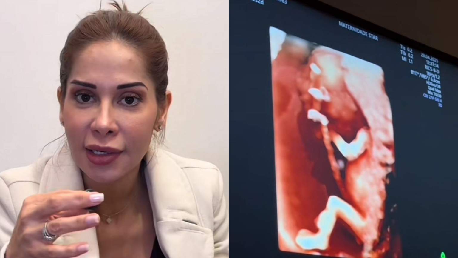 Maíra Cardi compartilha ultrassom da segunda gravidez e desabafa sobre ansiedade com exames genéticos