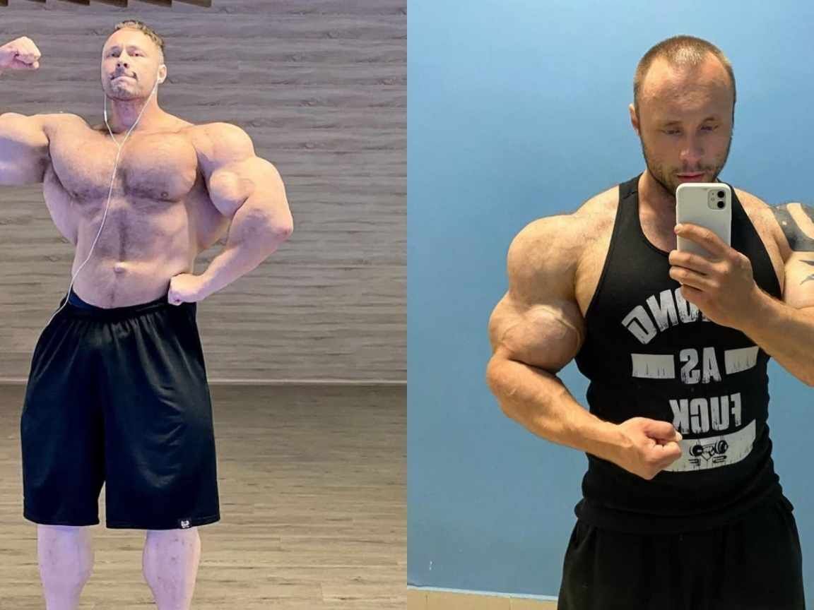 Morre Nikita Tkachuk aos 35 anos: fisiculturista russo sofreu falência múltipla de órgãos após uso de Synthol
