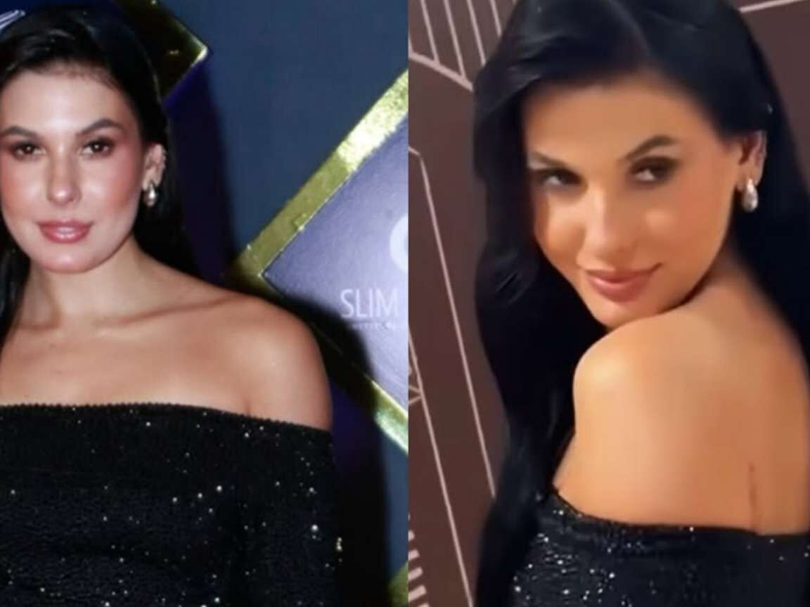 Ana Castela nega nova harmonização facial e rebate crítica de fã: 'Sou assim mesmo'