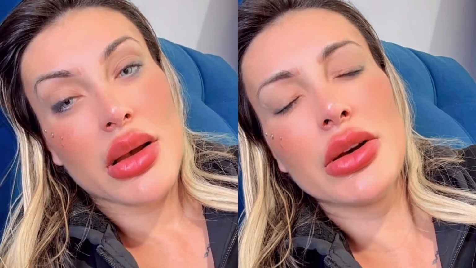 'Com medo de ficar cega': Andressa Urach relata piora e dor intensa após cirurgia nos olhos