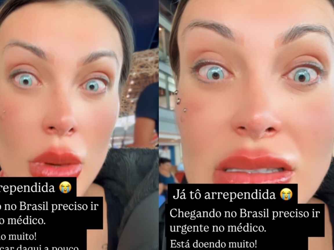 Andressa Urach se arrepende de cirurgia para mudar cor dos olhos e desabafa com dor: 'Orem por mim'