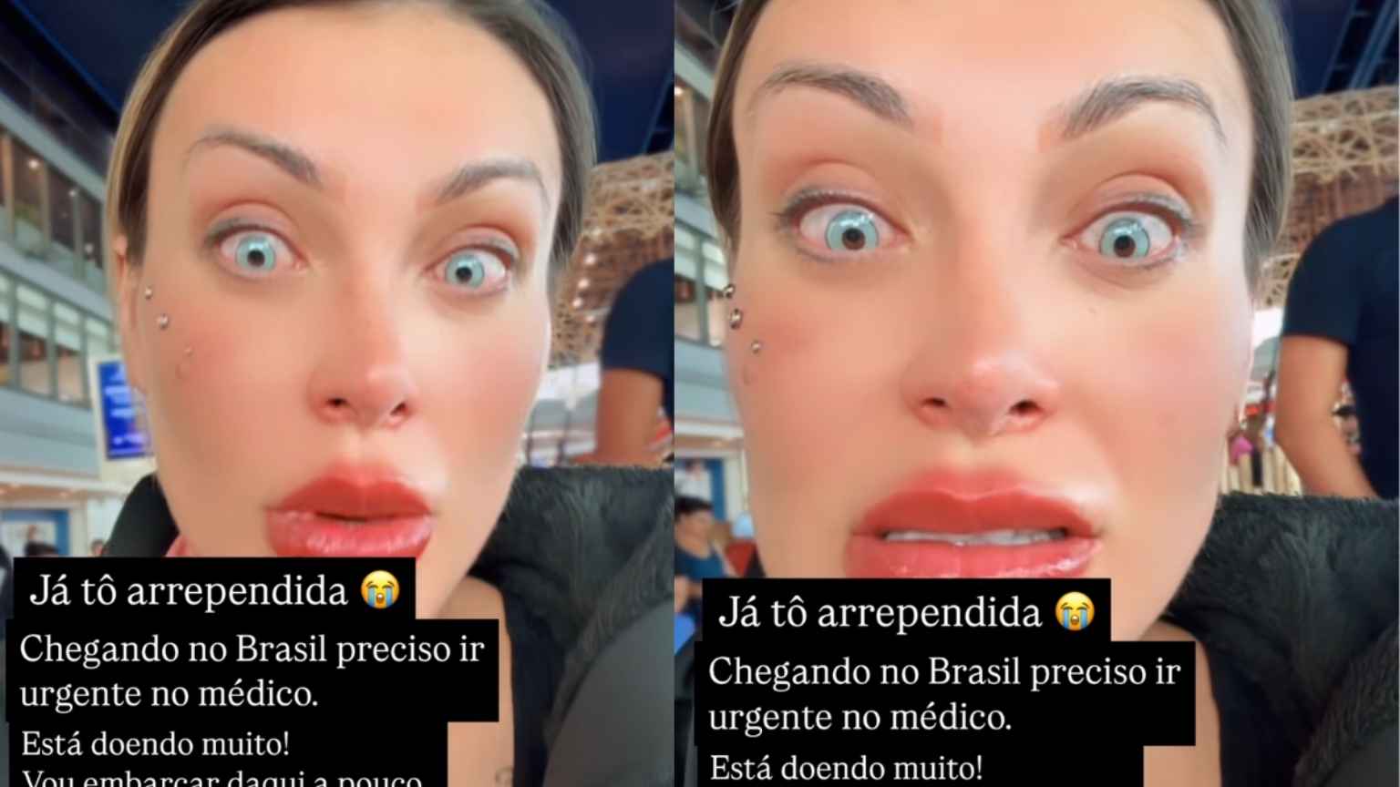 Andressa Urach se arrepende de cirurgia para mudar cor dos olhos e desabafa com dor: 'Orem por mim'