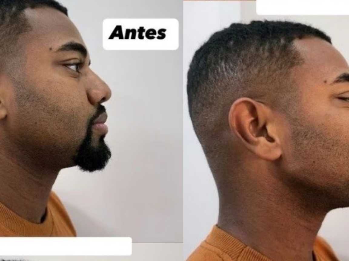 Davi Brito apresenta novo visual após lipo e até lente no dentes