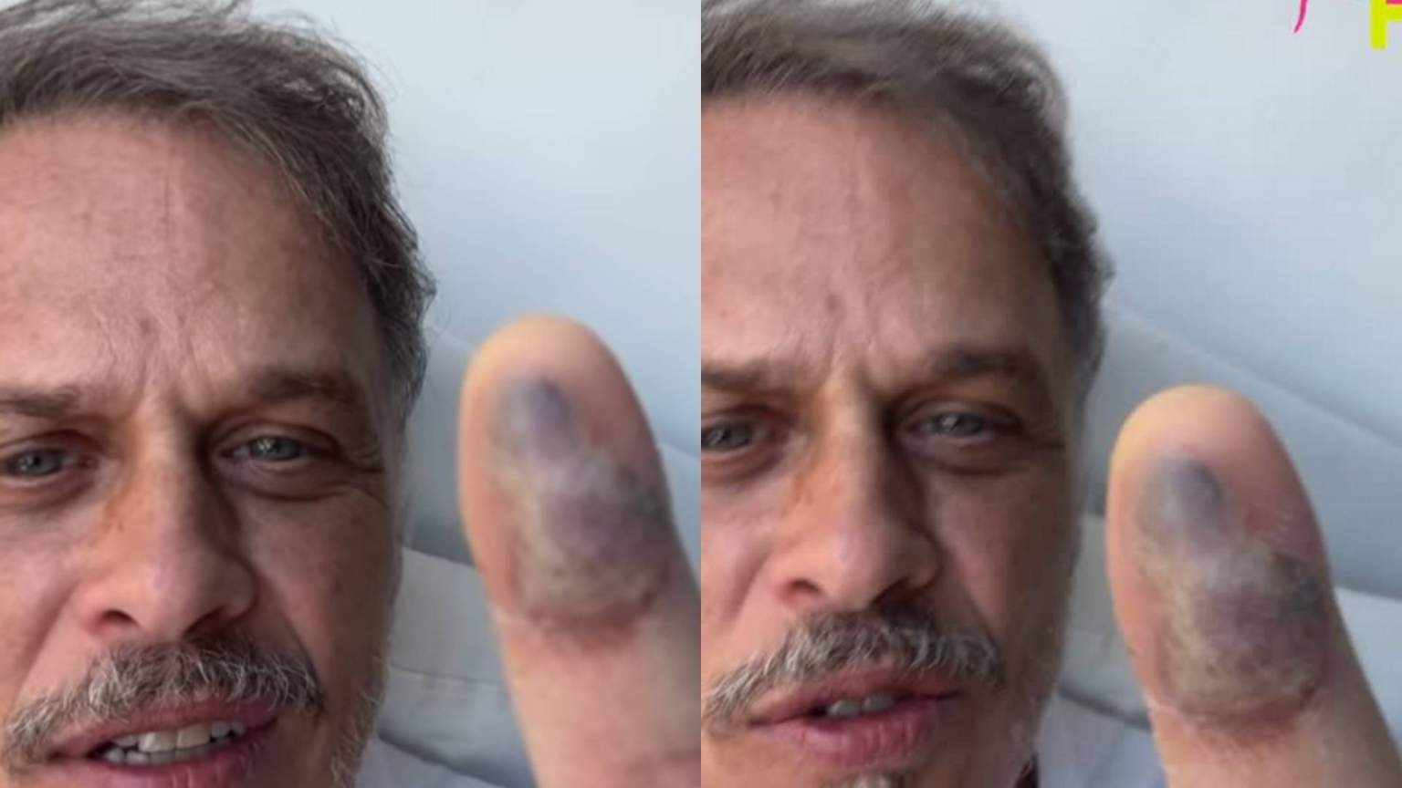 Recuperando-se de picada de jararaca, Guilherme Fontes brinca: