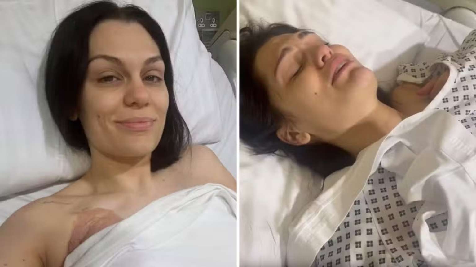 Jessie J se corrige após post sobre câncer de mama e anuncia pausa nas redes sociais