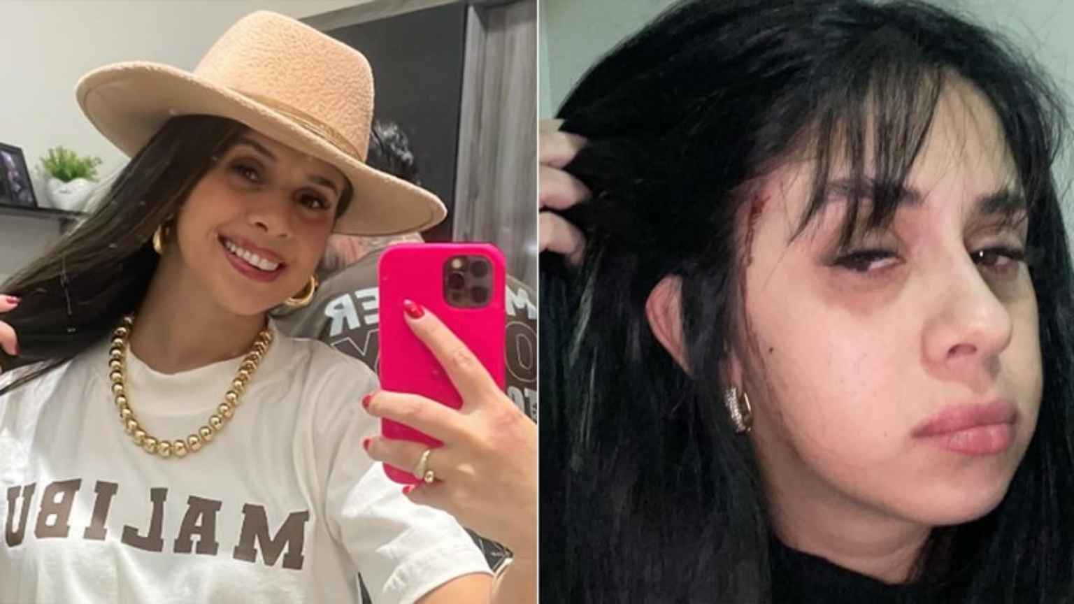 Cantora sertaneja Débora Amorim relata momentos de terror ao ser atacada e ter cabelo cortado em Blumenau