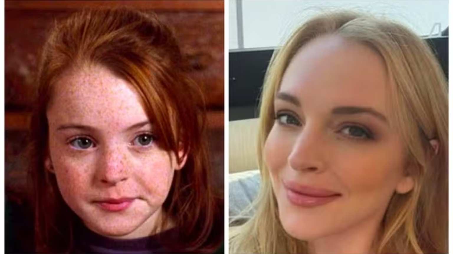 Sumiço das sardas de Lindsay Lohan é explicado por relação com dermatologista, diz jornal