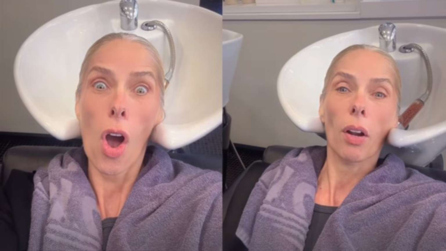 'Meu cabelo caiu horrores': Adriane Galisteu desabafa sobre queda de cabelo na menopausa