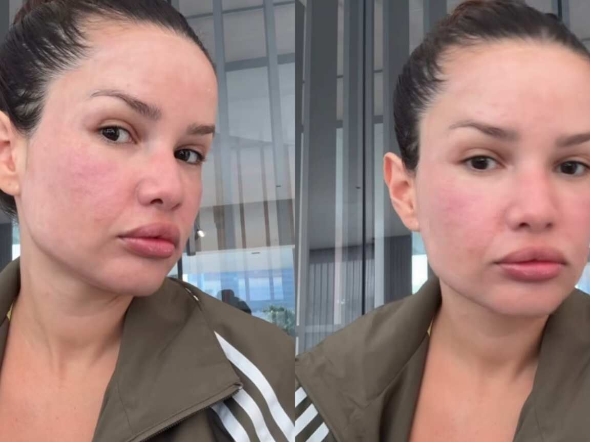 Juliette faz procedimento com 'esperma de salmão' e brinca com inchaço: 'Igual um baiacu'