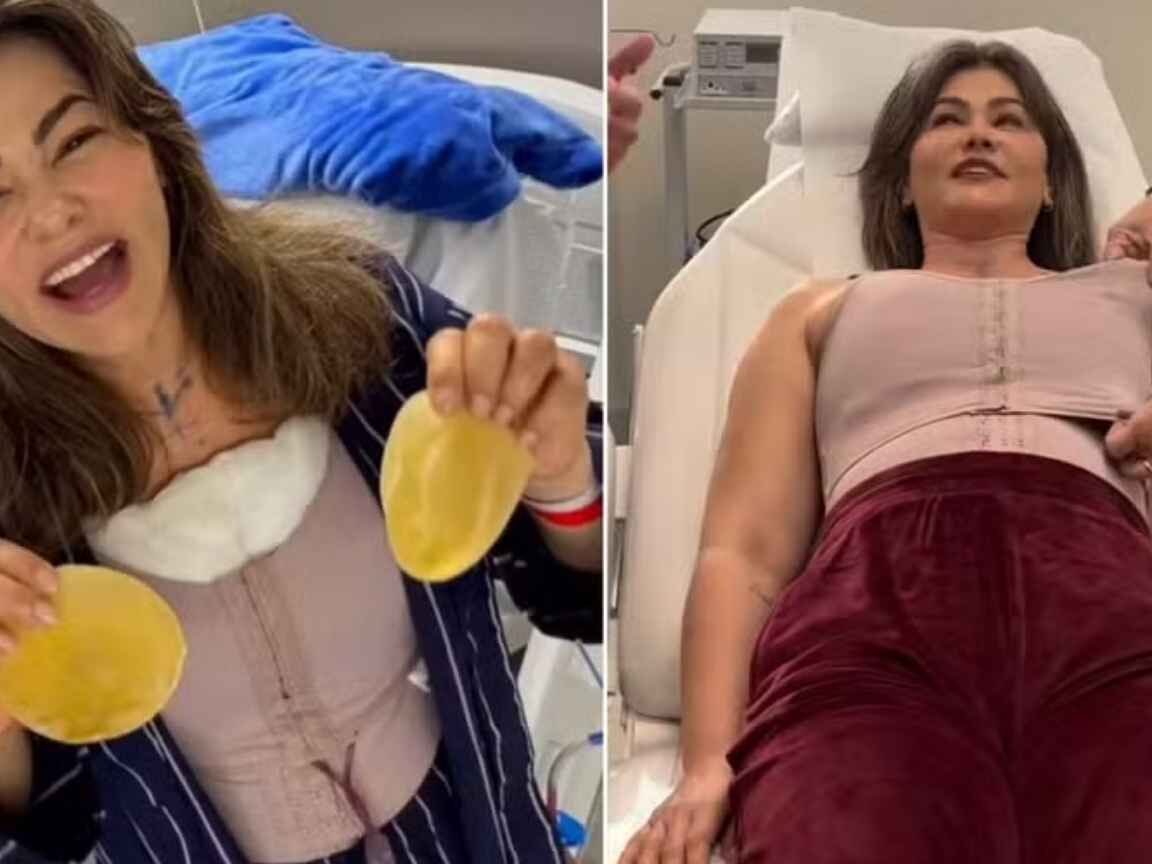 Suzana Alves retira silicone e se surpreende com resultado: 'Estou com o peito maior do que era'