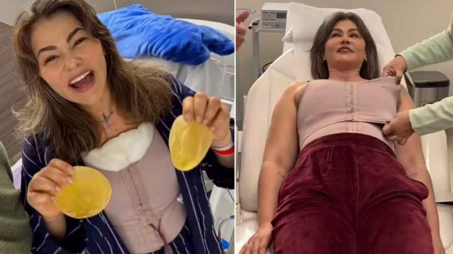 Suzana Alves retira silicone e se surpreende com resultado: 'Estou com o peito maior do que era'