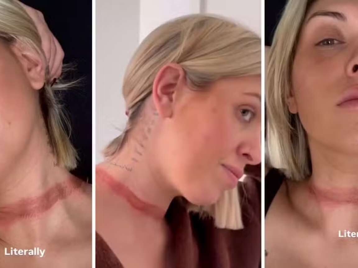 Influenciadora Eli Moulton quase é decapitada após echarpe prender em carro