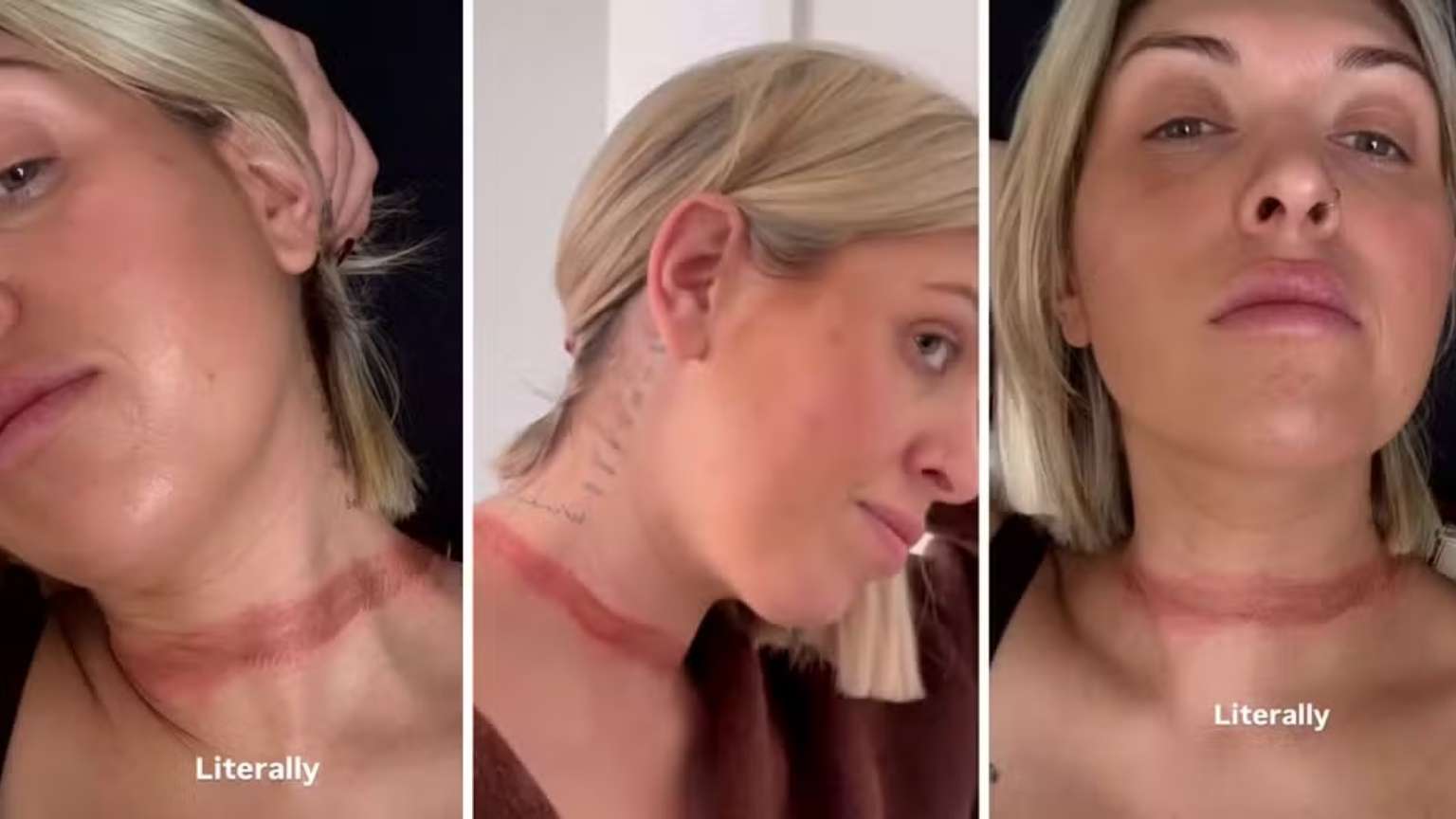 Influenciadora Eli Moulton quase é decapitada após echarpe prender em carro