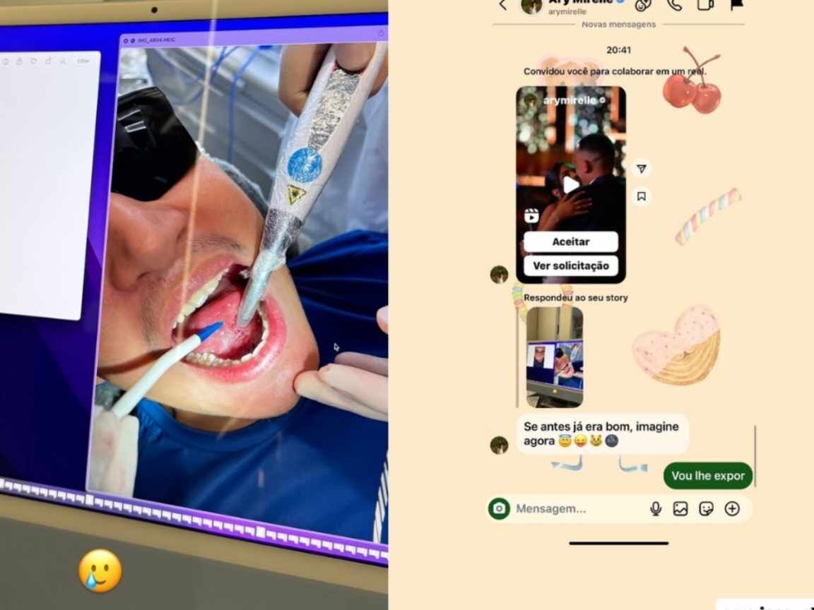 João Gomes faz cirurgia na língua e esposa, Ary Mirelle, reage: 'Se antes já era bom, imagine agora'