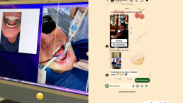 João Gomes faz cirurgia na língua e esposa, Ary Mirelle, reage: 'Se antes já era bom, imagine agora'