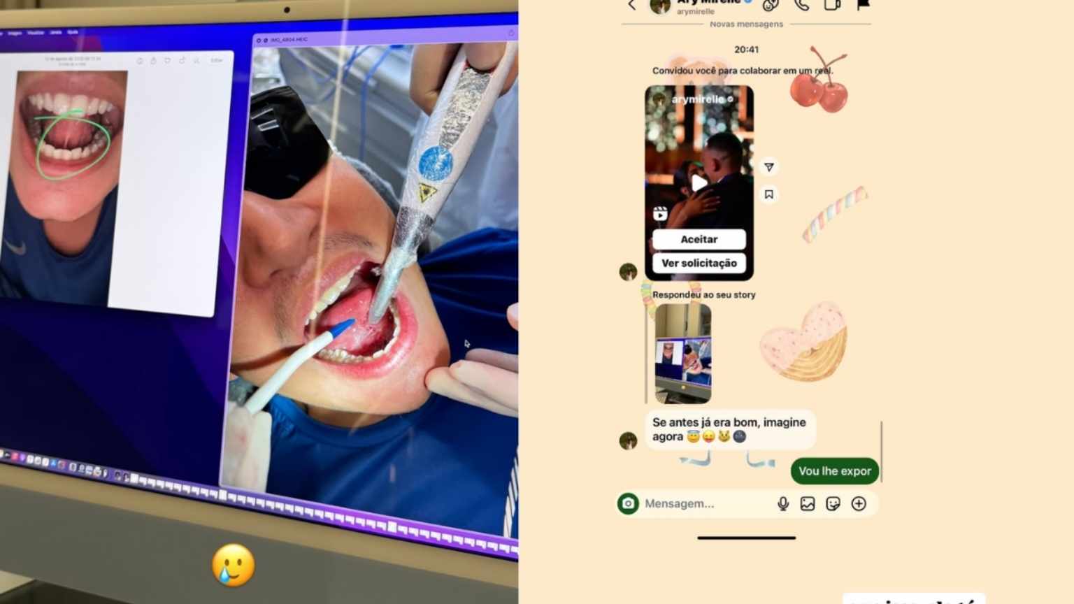 João Gomes faz cirurgia na língua e esposa, Ary Mirelle, reage: 'Se antes já era bom, imagine agora'